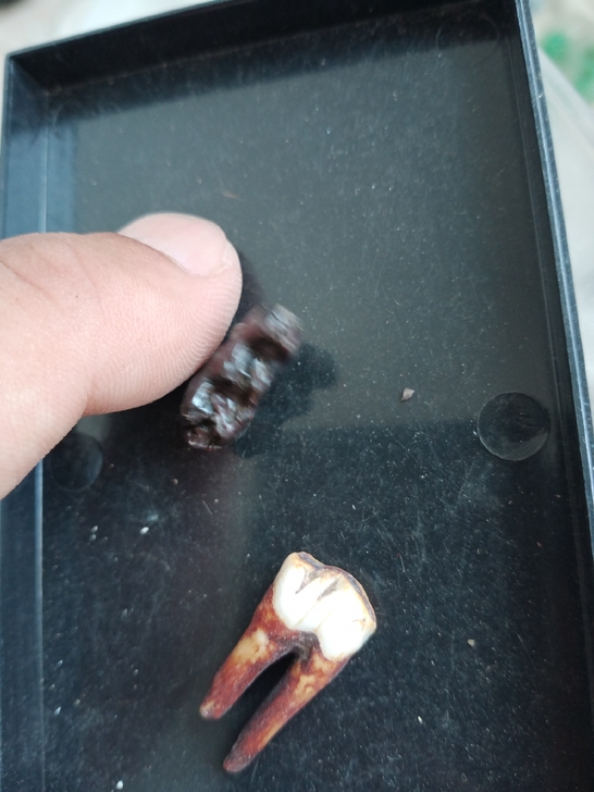 两颗牙齿化石,有喜欢的下单