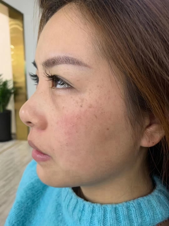 漂亮的脸蛋，健康，自然，通透。坚持调理，美...