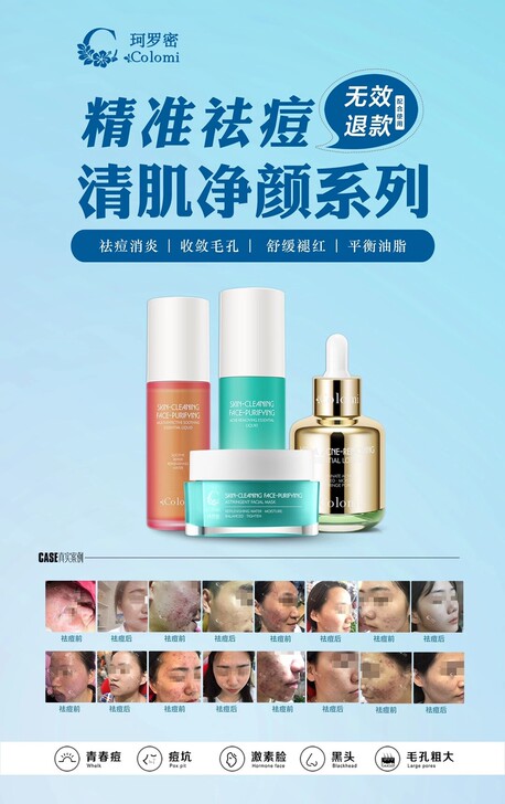 实体店全新正品 珂罗密祛痘精华全系列  祛...
