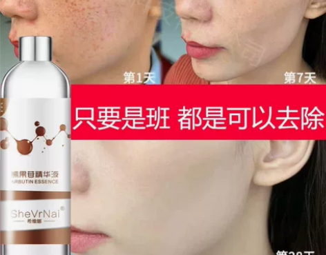 正品！熊果苷精华祛斑美白亮白肌肤保湿补水 ...